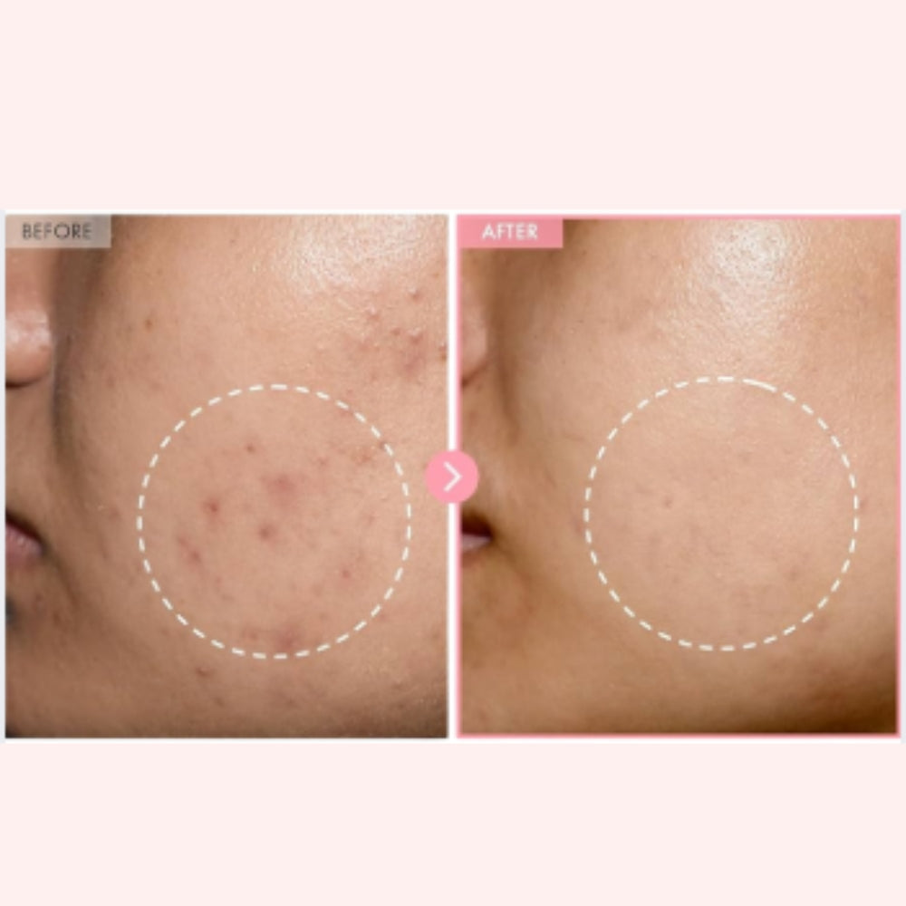 Pink Collagen Capsule Cream