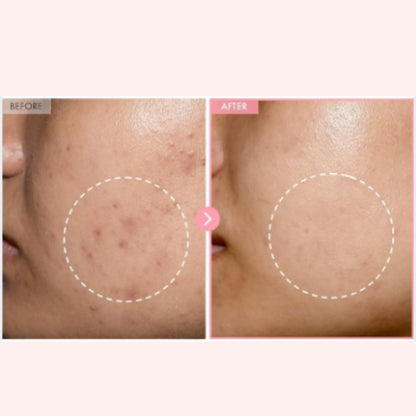 Pink Collagen Capsule Cream
